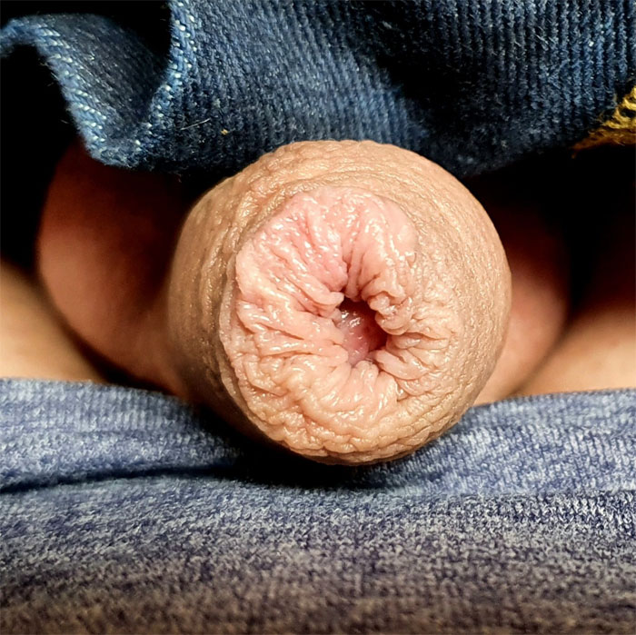 Foreskin Close-Up